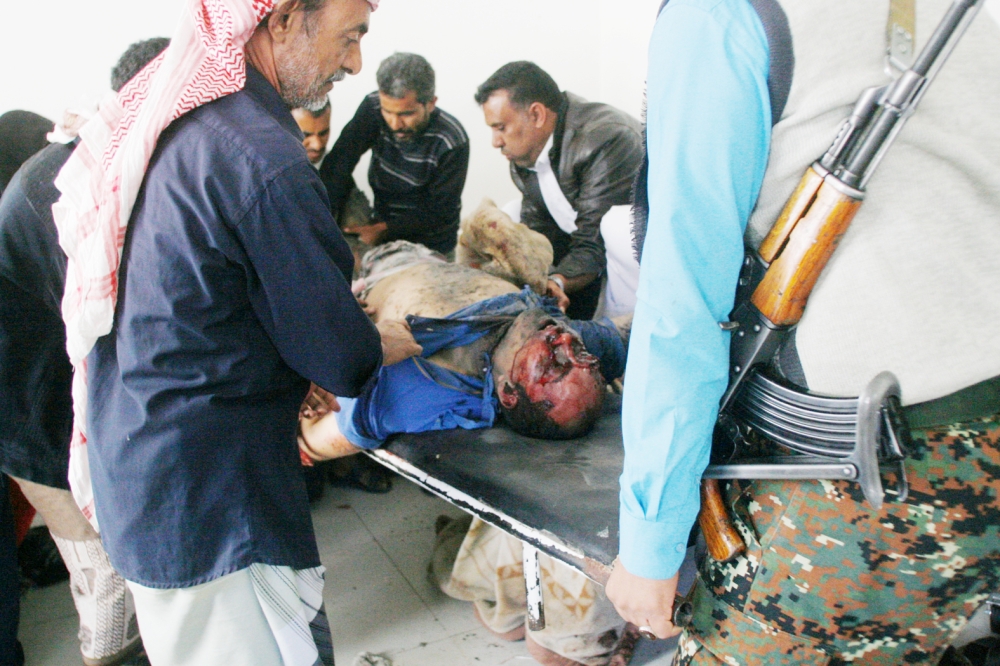 A pro-government fighter is being treated for injuries he sustained during fighting against Houthis in the southwestern city of Taiz, Yemen November 17, 2016. REUTERS/Anees Mahyoub  ATTENTION EDITORS - VISUAL COVERAGE OF SCENES OF INJURY OR DEATHTEMPLATE OUT