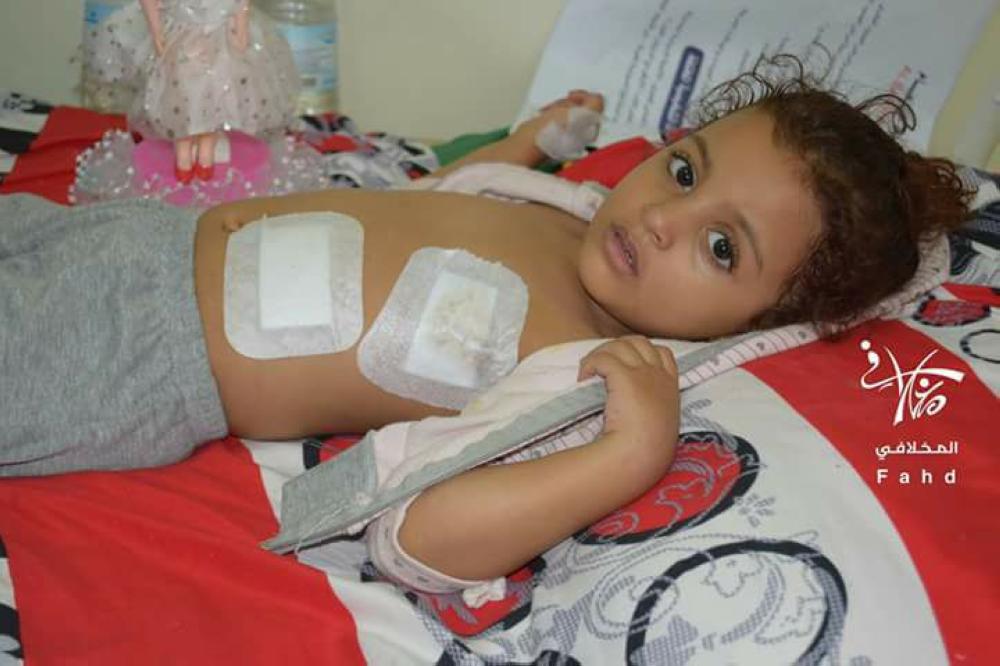 طفلة يمنية أصيبت في قصف للميلشسيات على أحياء تعز.(متداولة)