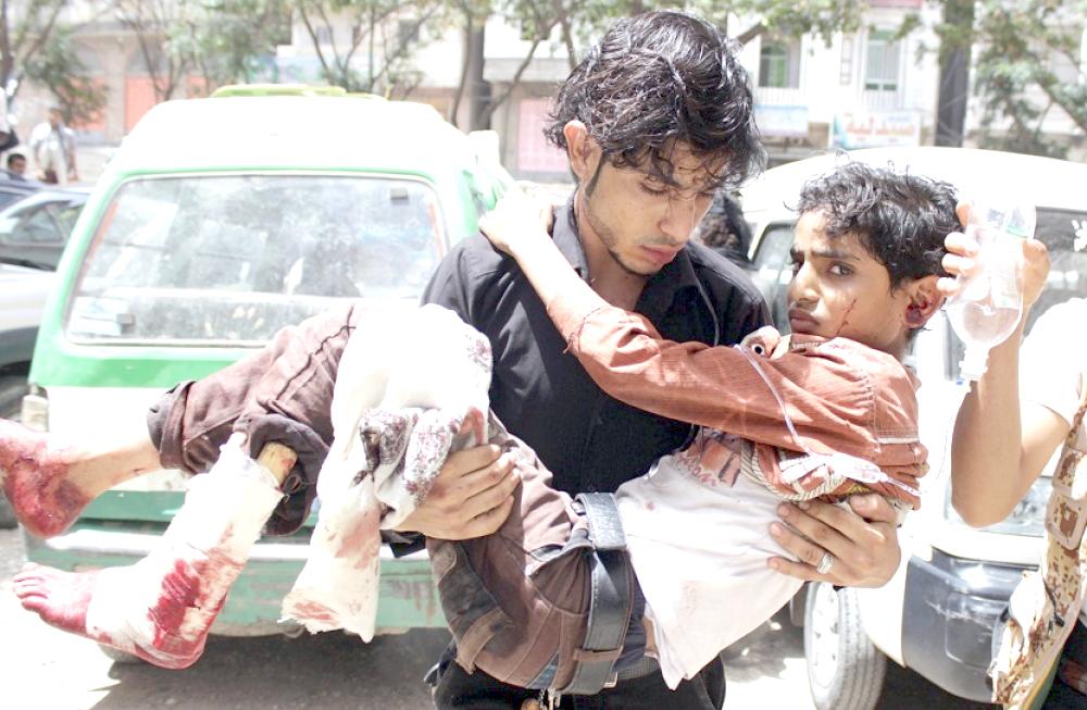 



طفل يمني أصيب في قصف للميليشيات الانقلابية.