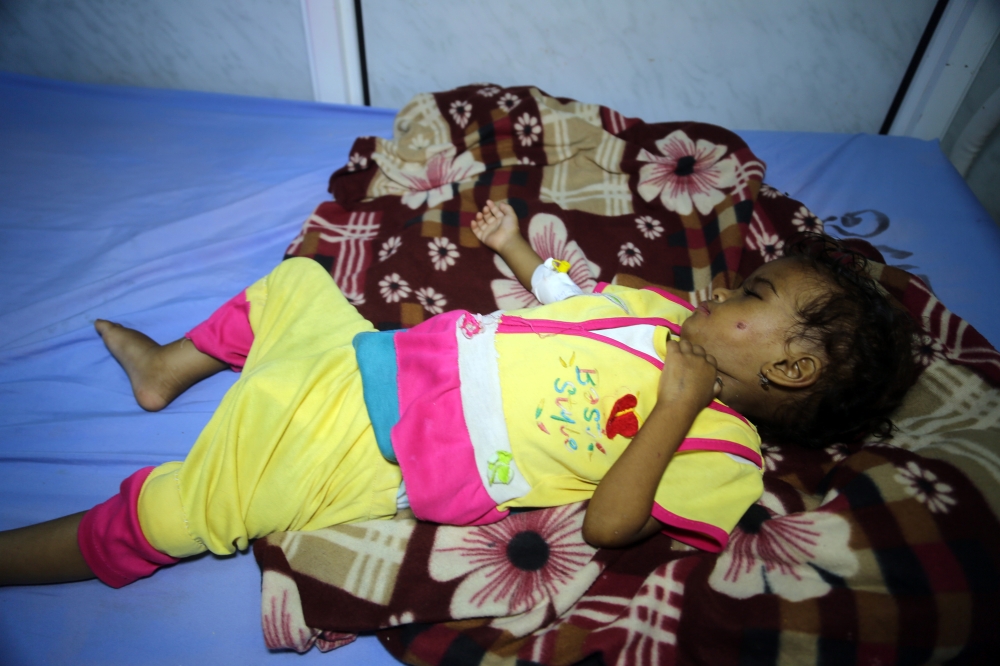 A Yemeni child receives treatment at a hospital in the Yemeni coastal city of Hodeidah on November 11, 2017. The Saudi-led coalition is still blocking desperately-needed UN aid deliveries to Yemen despite the re-opening of the port of Aden and of a land border crossing, a UN spokesman said on November 10.
The sea port at Hodeida, which is in rebel-held territory, is key to UN aid efforts as it is closest to the majority of people in need. / AFP / ABDO HYDER
