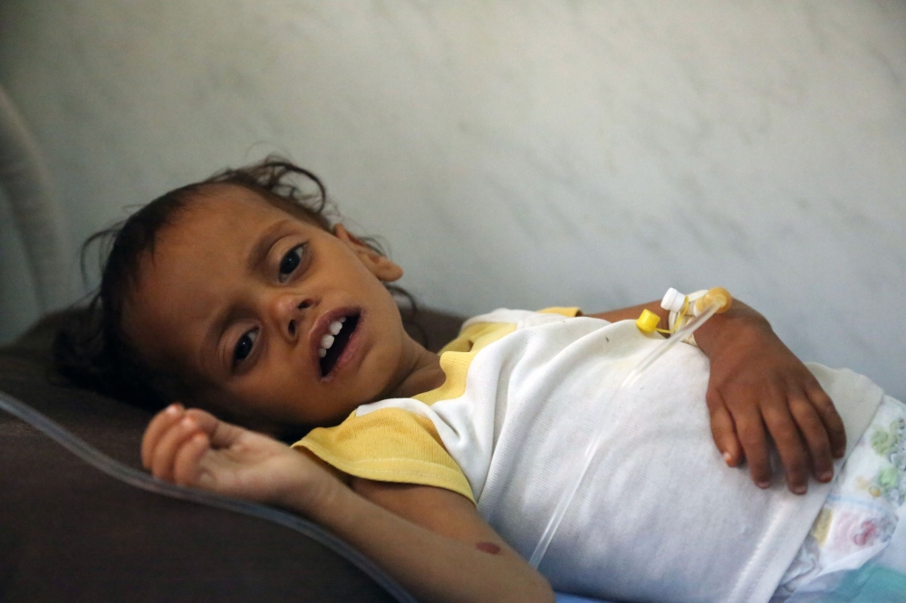 A Yemeni child receives treatment at a hospital in the Yemeni coastal city of Hodeidah on November 11, 2017. The Saudi-led coalition is still blocking desperately-needed UN aid deliveries to Yemen despite the re-opening of the port of Aden and of a land border crossing, a UN spokesman said on November 10.
The sea port at Hodeida, which is in rebel-held territory, is key to UN aid efforts as it is closest to the majority of people in need. / AFP / ABDO HYDER
