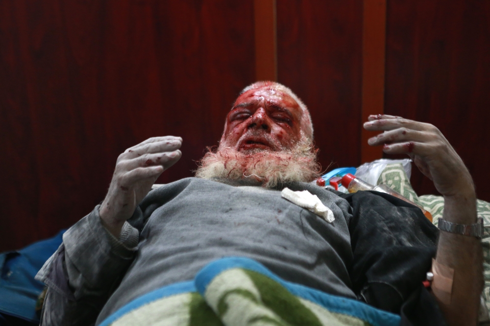 EDITORS NOTE: Graphic content / A Syrian man waits for treatment at a makeshift morgue in the rebel-controlled town of Hamouria, in the eastern Ghouta region on the outskirts of the capital Damascus, on November 27, 2017, following reported bombardment by government forces. / AFP / ABDULMONAM EASSA
