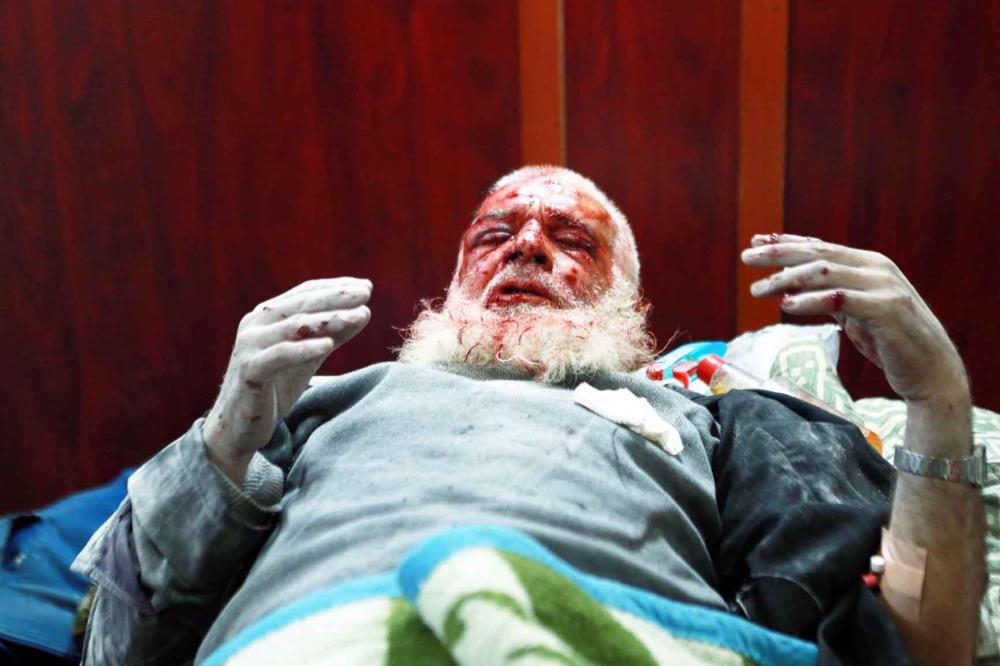 EDITORS NOTE: Graphic content / A Syrian man waits for treatment at a makeshift morgue in the rebel-controlled town of Hamouria, in the eastern Ghouta region on the outskirts of the capital Damascus, on November 27, 2017, following reported bombardment by government forces.  / AFP / ABDULMONAM EASSA
