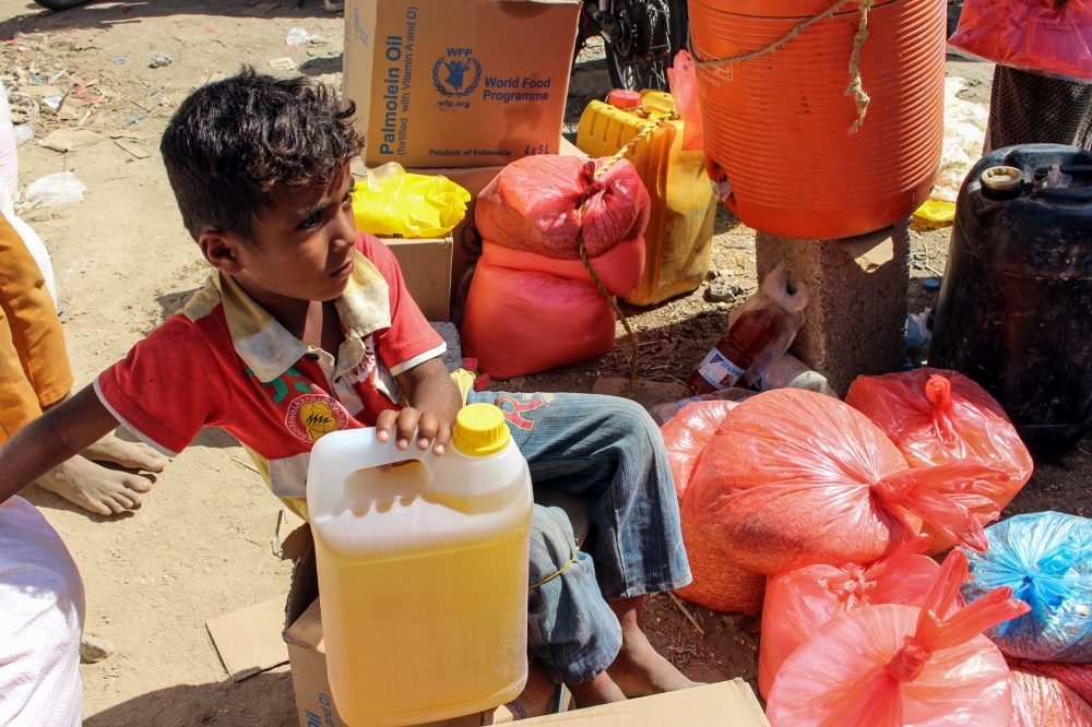 A Yemeni boy grasps a container of cooking oil as he sits next to bags of food aid distributed by a local charity at a camp for the displaced, in the northern province of Hajjah on December 23, 2017.  / AFP / STRINGER
