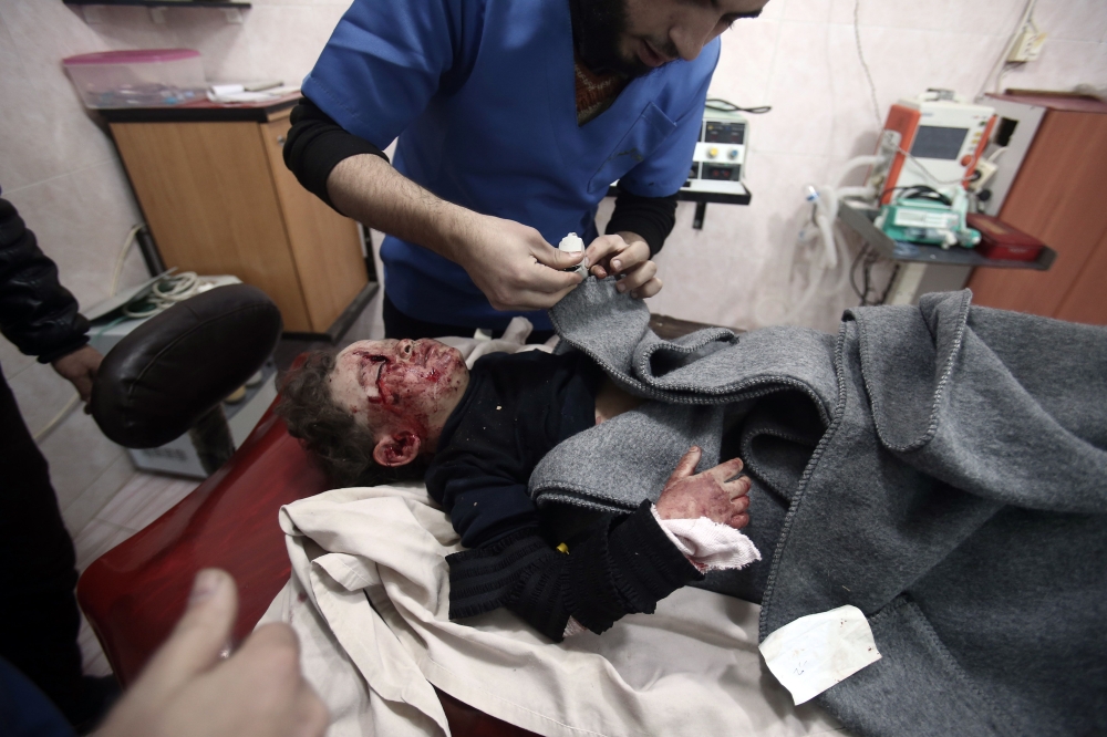 A Syrian child receives treatment at a makeshift hospital, following a  in the rebel-held besieged town of Arbin, in the eastern Ghouta region on the outskirts of the capital Damascus on January 5, 2018.  / AFP / ABDULMONAM EASSA
