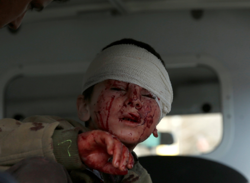 ATTENTION EDITORS - VISUAL COVERAGE OF SCENES OF INJURY An injured boy sits in an ambulance after a blast in Kabul, Afghanistan January 27, 2018. REUTERS/Mohammad Ismail TEMPLATE OUT