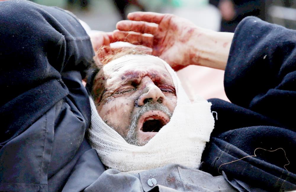 ATTENTION EDITORS - VISUAL COVERAGE OF SCENES OF INJURY OR DEATH An injured man arrives outside the hospital after a blast in Kabul, Afghanistan January 27, 2018. REUTERS/Mohammad Ismail