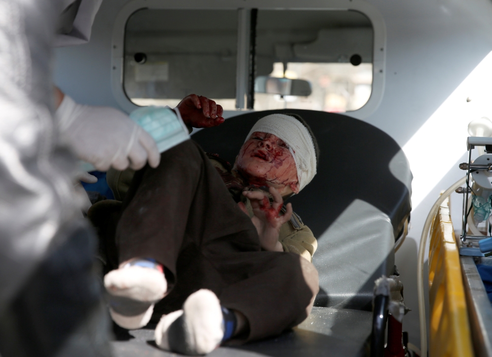 ATTENTION EDITORS - VISUAL COVERAGE OF SCENES OF INJURY An injured boy is seen in an ambulance after a blast in Kabul, Afghanistan January 27, 2018. REUTERS/Mohammad Ismail TEMPLATE OUT