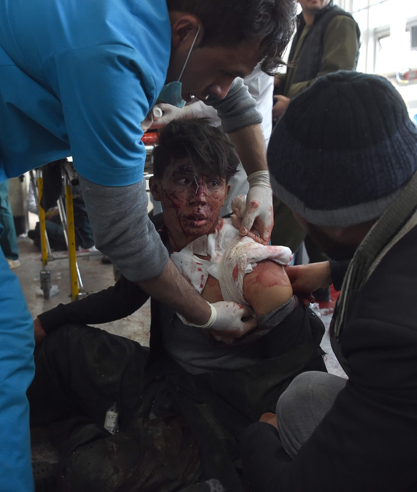 Afghan medical staff treat a wounded boy, after a car bomb exploded near the old Interior Ministry building, at Jamhuriat Hospital in Kabul on January 27, 2018. An ambulance packed with explosives blew up in a crowded area of Kabul on January 27, killing at least 40 people and wounding 110 others, officials said, in an attack claimed by the Taliban.
 / AFP / WAKIL KOHSAR
