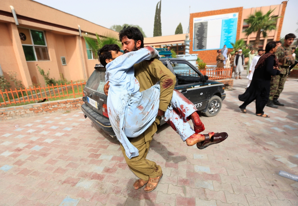 ATTENTION EDITORS - VISUAL COVERAGE OF SCENES OF INJURY OR DEATH ??An injured man is carried to a hospital after a car bomb in Jalalabad city, Afghanistan June 17, 2018. REUTERS/Parwiz