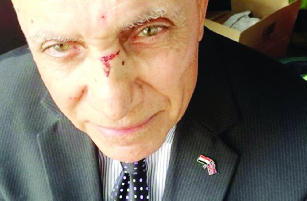 



آثار الاعتداء على وجه مصطفى رجب.