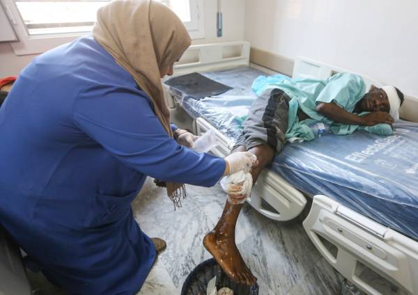 EDITORS NOTE: Graphic content / A nurse cleans the wound of an injured migrant at a medical emergency ward in a hospital in the capital Tripoli on July 3, 2019, following an air strike on a nearby building that left dozens killed the previous night. Over 40 migrants were killed in an air strike early late on July 2 on their detention centre in a Tripoli suburb blamed on Libyan strongman Khalifa Haftar, who has been trying for three months to seize the capital. The UN said the air strike «may amount to a war crime». More than 130 people were also wounded in the in the raid on Tajoura, the statement added. / AFP / Mahmud TURKIA 