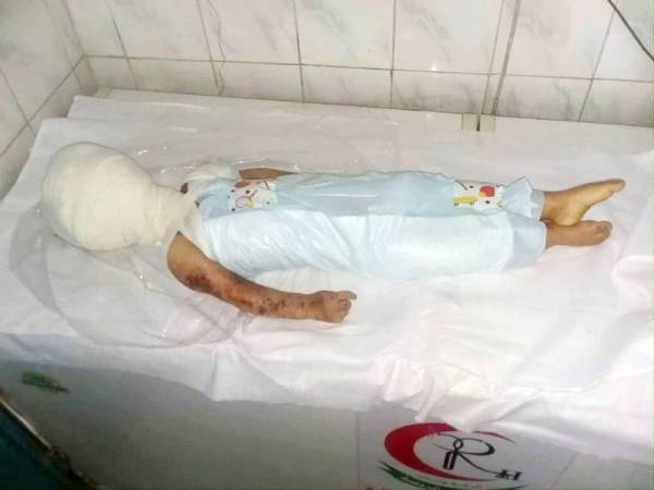 



طفلة يمنية قتلتها المليشيا الحوثية في قصف على أحد الأحياء السكنية في تعز أمس. «عكاظ» تعتذر لنشر الصورة. (متداولة)