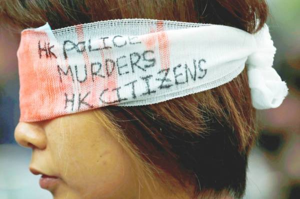 



متظاهرة تغطي عينيها بشاش أثناء مظاهرة حاشدة احتجاجا على إطلاق النار على امرأة في العين، أثناء احتجاجات في مطار هونغ كونغ. (رويترز)