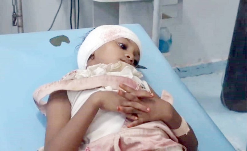 



طفلة يمنية أصيبت بجروح خطيرة بسبب ألغام الحوثي في الحديدة أمس.