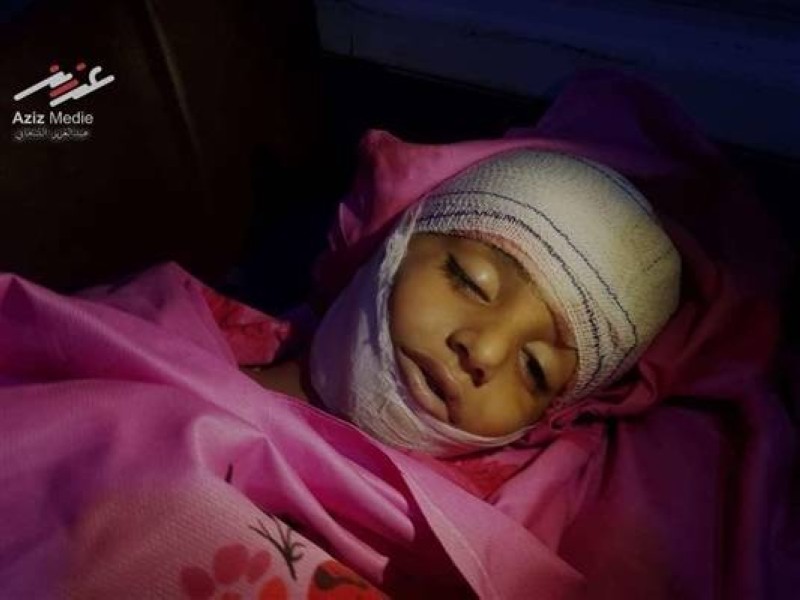 الطفل حسان عبدالله قتل بقصف حوثي على تعز اليوم.