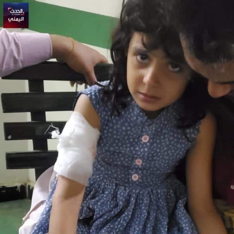 طفلة اصيبت بالقصف الحوثي على تعز